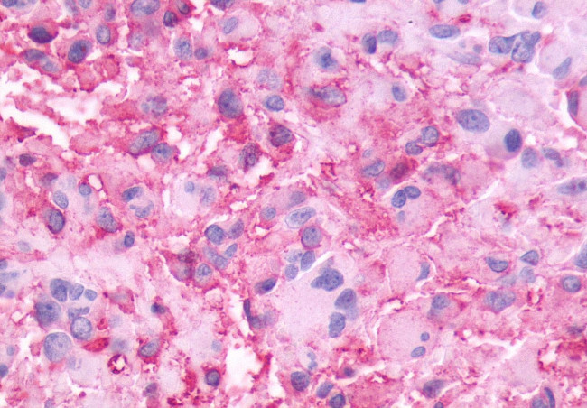 NMBR Antibody in Immunohistochemistry (Paraffin) (IHC (P))