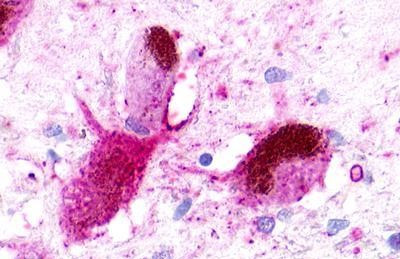 NMUR1 Antibody in Immunohistochemistry (Paraffin) (IHC (P))