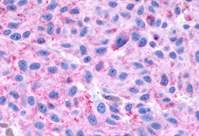 NPBWR1 Antibody in Immunohistochemistry (Paraffin) (IHC (P))