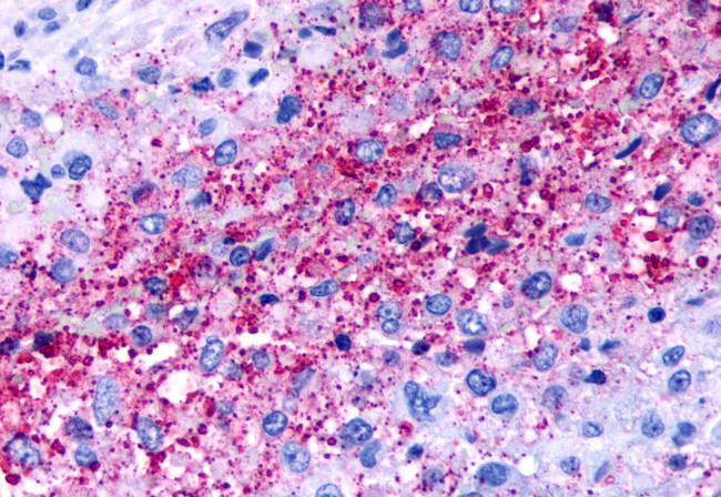 NPBWR1 Antibody in Immunohistochemistry (Paraffin) (IHC (P))