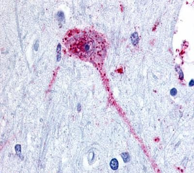 NPBWR1 Antibody in Immunohistochemistry (Paraffin) (IHC (P))