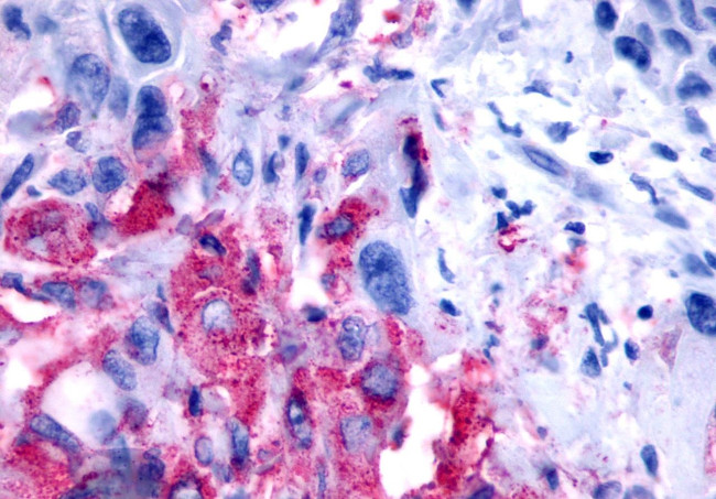 NPBWR2 Antibody in Immunohistochemistry (Paraffin) (IHC (P))