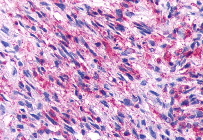 NPBWR2 Antibody in Immunohistochemistry (Paraffin) (IHC (P))