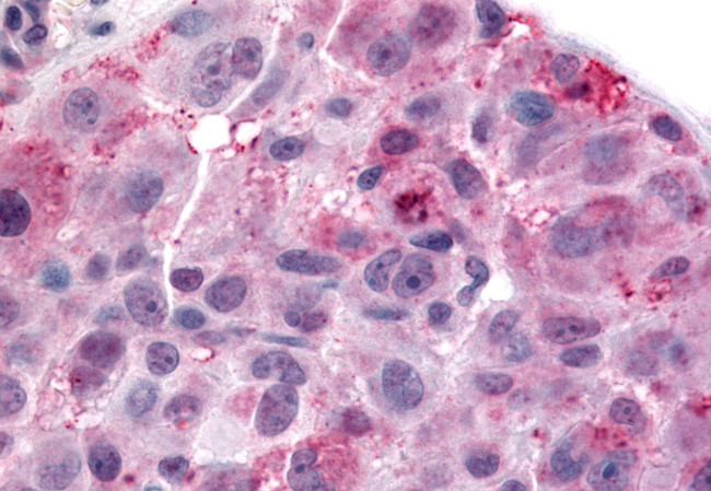 NPBWR2 Antibody in Immunohistochemistry (Paraffin) (IHC (P))