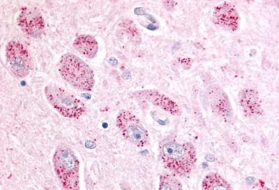 NPBWR2 Antibody in Immunohistochemistry (Paraffin) (IHC (P))