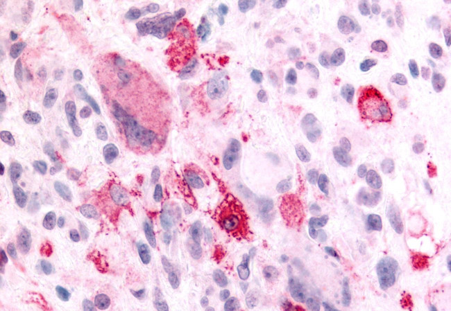 NPBWR2 Antibody in Immunohistochemistry (Paraffin) (IHC (P))