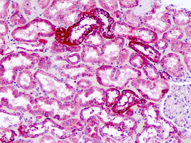 NPY1R Antibody in Immunohistochemistry (Paraffin) (IHC (P))