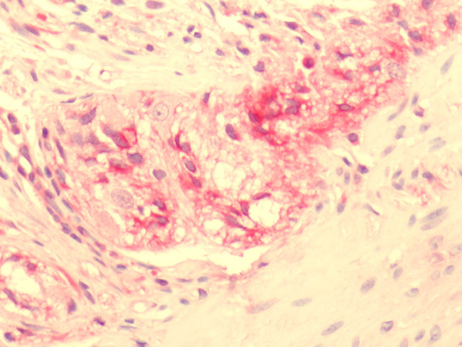 NPY2R Antibody in Immunohistochemistry (Paraffin) (IHC (P))