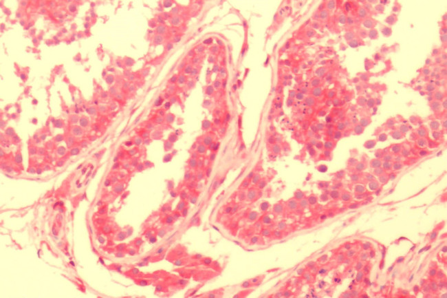 NPY2R Antibody in Immunohistochemistry (Paraffin) (IHC (P))