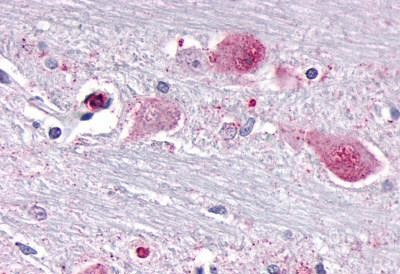 NR1D1 Antibody in Immunohistochemistry (Paraffin) (IHC (P))