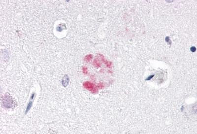 NR1D1 Antibody in Immunohistochemistry (Paraffin) (IHC (P))