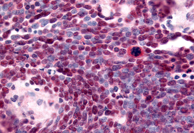 TLX Antibody in Immunohistochemistry (Paraffin) (IHC (P))