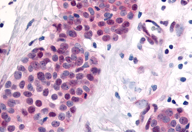 TLX Antibody in Immunohistochemistry (Paraffin) (IHC (P))