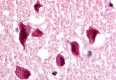 TLX Antibody in Immunohistochemistry (Paraffin) (IHC (P))