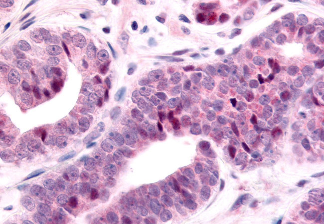 TLX Antibody in Immunohistochemistry (Paraffin) (IHC (P))