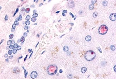 EAR2 Antibody in Immunohistochemistry (Paraffin) (IHC (P))