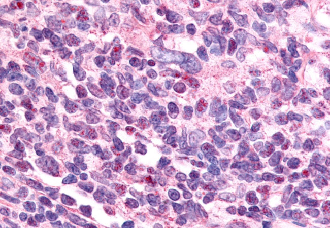 EAR2 Antibody in Immunohistochemistry (Paraffin) (IHC (P))