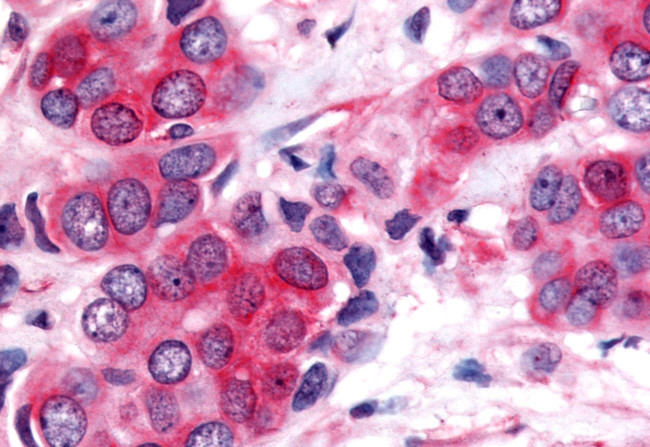 NOR-1 Antibody in Immunohistochemistry (Paraffin) (IHC (P))