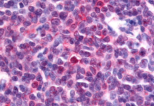 NOR-1 Antibody in Immunohistochemistry (Paraffin) (IHC (P))