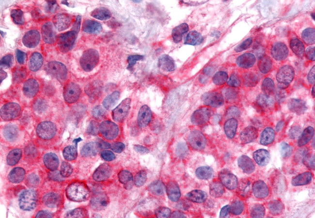 NOR-1 Antibody in Immunohistochemistry (Paraffin) (IHC (P))