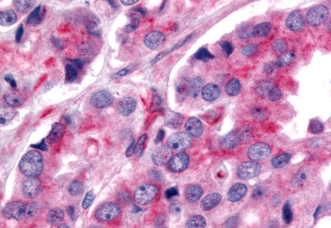 NOR-1 Antibody in Immunohistochemistry (Paraffin) (IHC (P))