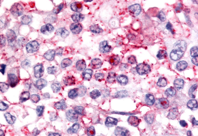 NOR-1 Antibody in Immunohistochemistry (Paraffin) (IHC (P))