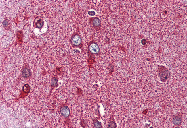 NOR-1 Antibody in Immunohistochemistry (Paraffin) (IHC (P))