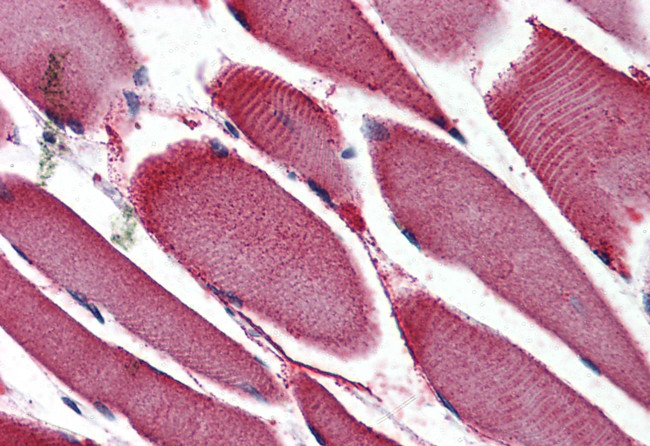 NOR-1 Antibody in Immunohistochemistry (Paraffin) (IHC (P))