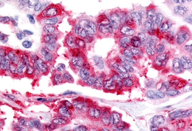 NOR-1 Antibody in Immunohistochemistry (Paraffin) (IHC (P))