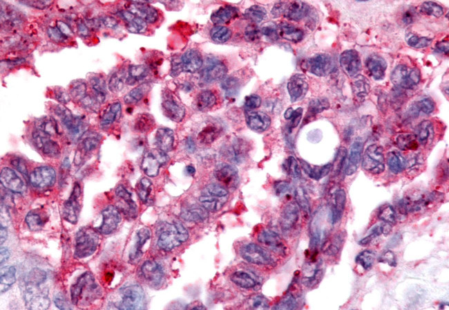 NOR-1 Antibody in Immunohistochemistry (Paraffin) (IHC (P))