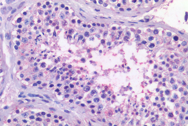 NR5A1 Antibody in Immunohistochemistry (Paraffin) (IHC (P))