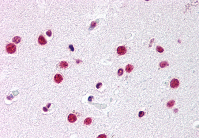 NR5A1 Antibody in Immunohistochemistry (Paraffin) (IHC (P))