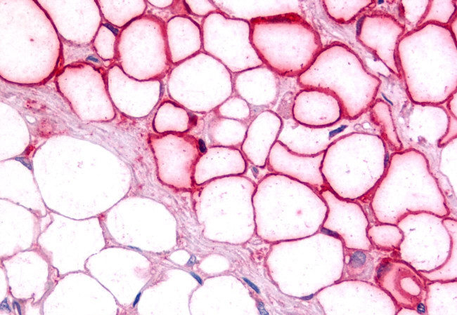 NR5A2 Antibody in Immunohistochemistry (Paraffin) (IHC (P))