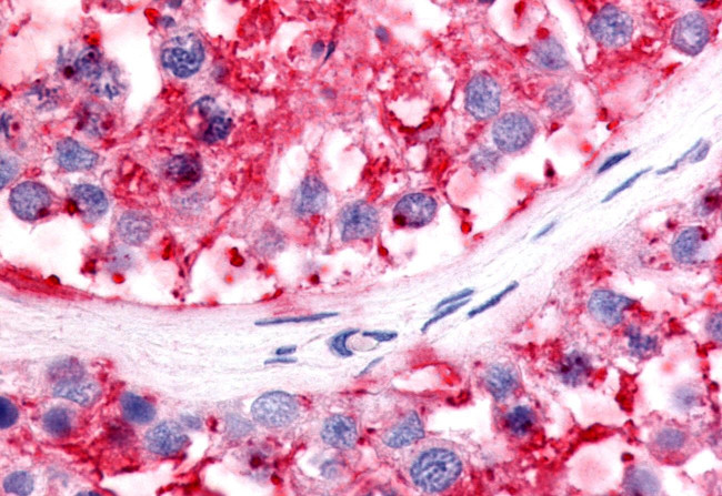 NR5A2 Antibody in Immunohistochemistry (Paraffin) (IHC (P))