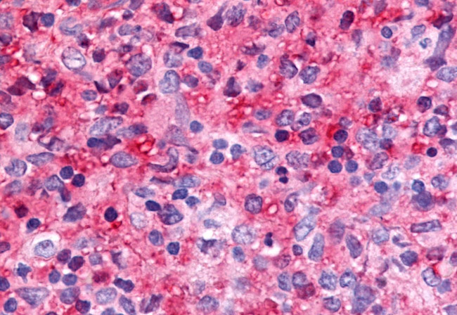 NR5A2 Antibody in Immunohistochemistry (Paraffin) (IHC (P))