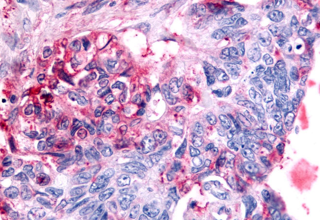 GCNF Antibody in Immunohistochemistry (Paraffin) (IHC (P))