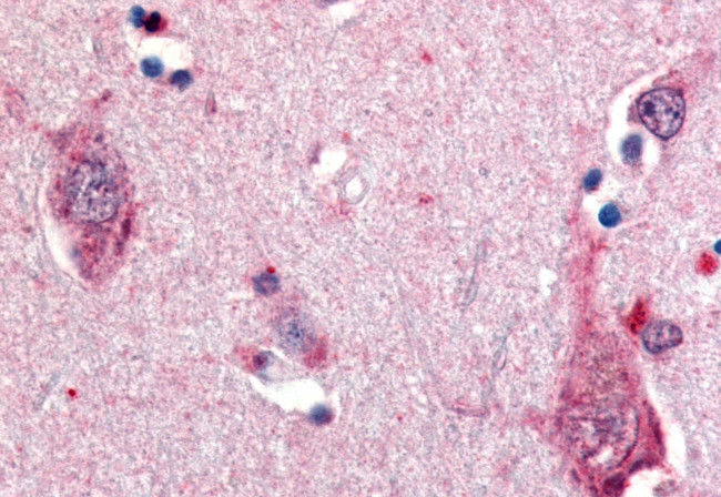 TrkB Antibody in Immunohistochemistry (Paraffin) (IHC (P))