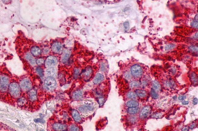 NTSR1 Antibody in Immunohistochemistry (Paraffin) (IHC (P))