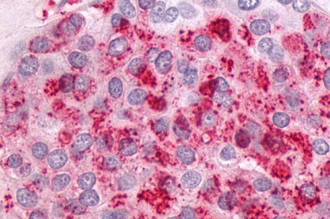 NTSR1 Antibody in Immunohistochemistry (Paraffin) (IHC (P))