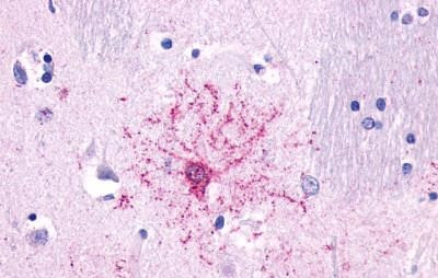 NTSR2 Antibody in Immunohistochemistry (Paraffin) (IHC (P))