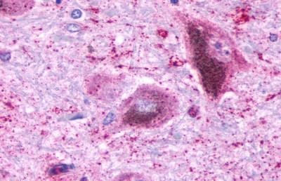 NTSR2 Antibody in Immunohistochemistry (Paraffin) (IHC (P))