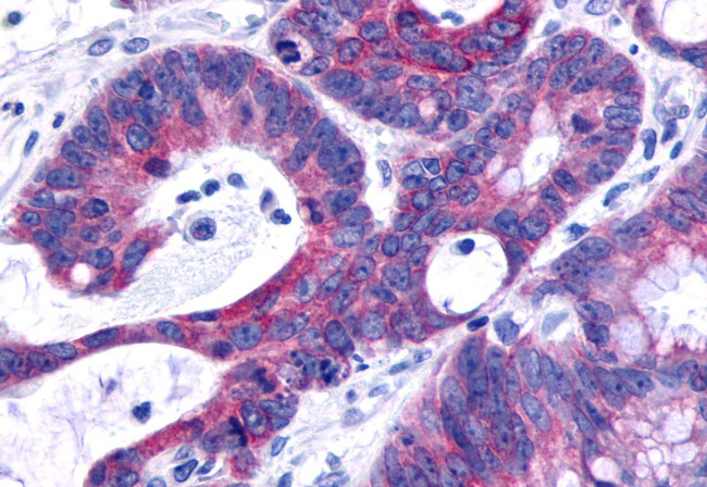 GPR120 Antibody in Immunohistochemistry (Paraffin) (IHC (P))