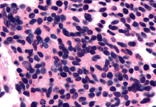 Opsin 3 Antibody in Immunohistochemistry (Paraffin) (IHC (P))