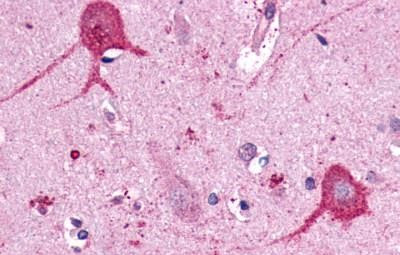 Opsin 3 Antibody in Immunohistochemistry (Paraffin) (IHC (P))