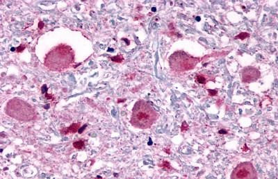 Opsin 3 Antibody in Immunohistochemistry (Paraffin) (IHC (P))