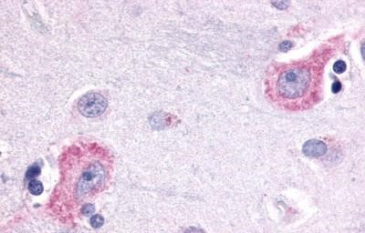 Opsin 3 Antibody in Immunohistochemistry (Paraffin) (IHC (P))