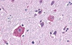 Opsin 3 Antibody in Immunohistochemistry (Paraffin) (IHC (P))