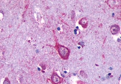 Opsin 5 Antibody in Immunohistochemistry (Paraffin) (IHC (P))