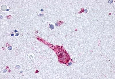 OPRM1 Antibody in Immunohistochemistry (Paraffin) (IHC (P))