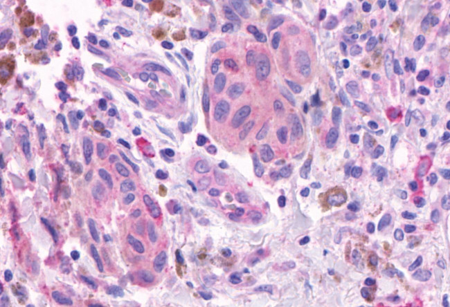 OR2A4 Antibody in Immunohistochemistry (Paraffin) (IHC (P))